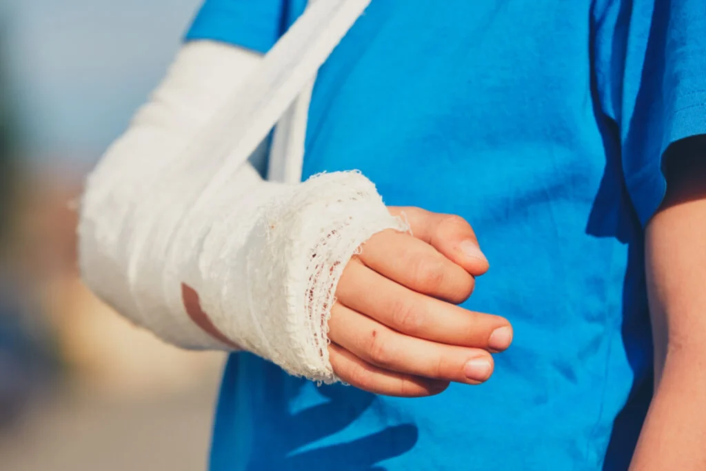 Close-up of a child wearing a white arm cast in a sling